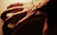 Fibromyalgia Causes and Solutions Fibromyalgia Causes and Solutions